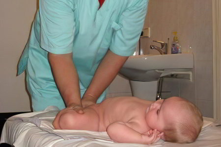 Изображение - Дисплазия тазобедренного сустава у ребенка 1 год lechenie-displazii465446