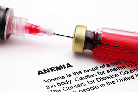 Как лечить анемию 2 степени