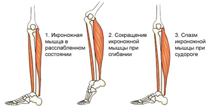 mehanizm razvitiya sydorogi