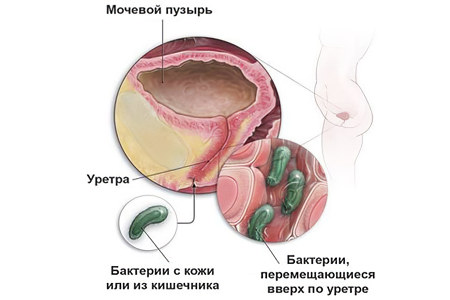 Причиной боли может