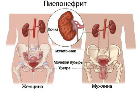 Осложнения и последствия