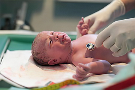 Острая гипоксия у новорождённого