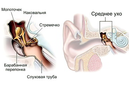 Воспаление среднего уха симптомы лечение