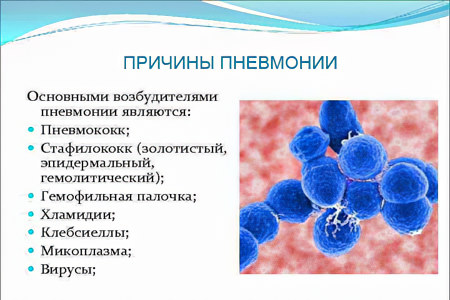 Пневмония без температуры