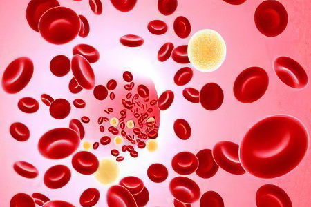 Почему развивается анемия