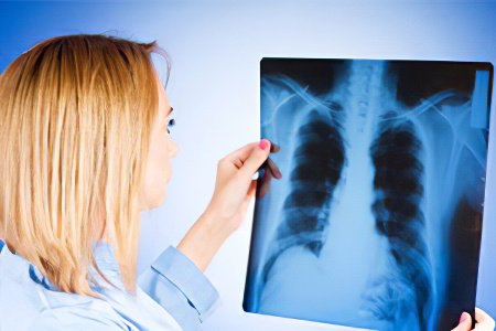 Причины рака лёгких