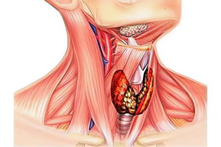 Причины рака щитовидной железы