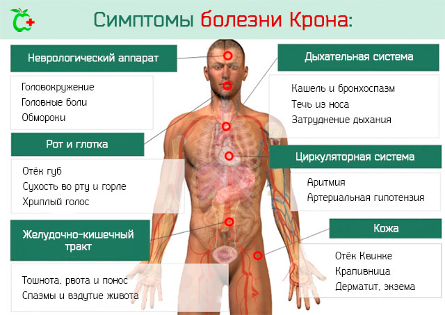 Внекишечные симптомы болезни