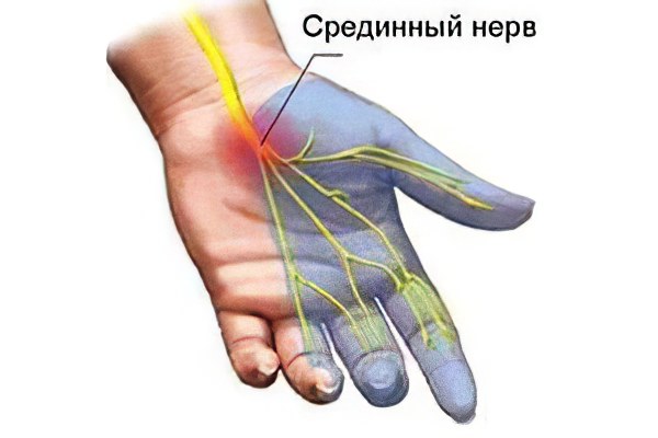 средний нерв средний нерв