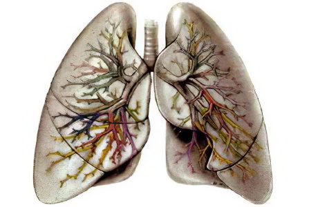 Стадии рака лёгких
