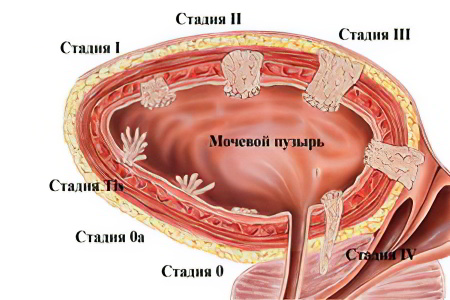 Стадии