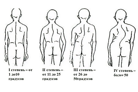 Классификация Классификация