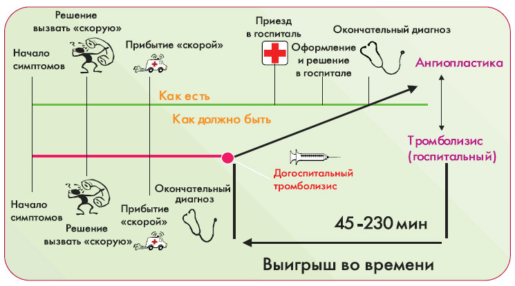 выигрыш времени