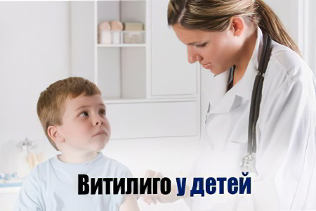 витилиго у детей витилиго у детей