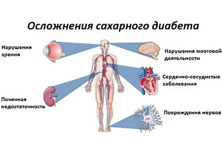 Возможные осложнения