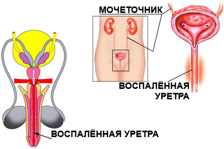 мочеполовая система