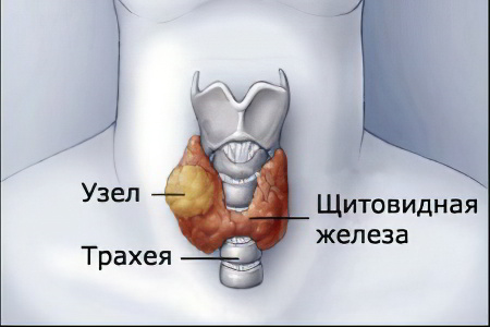 Где Находится Щитовидка Фото