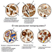 Копрограмма