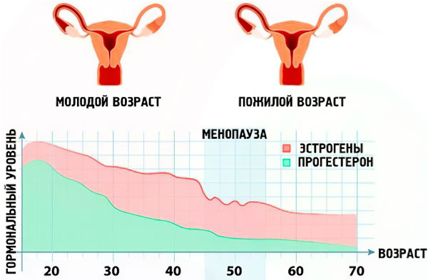 Климакс у женщин