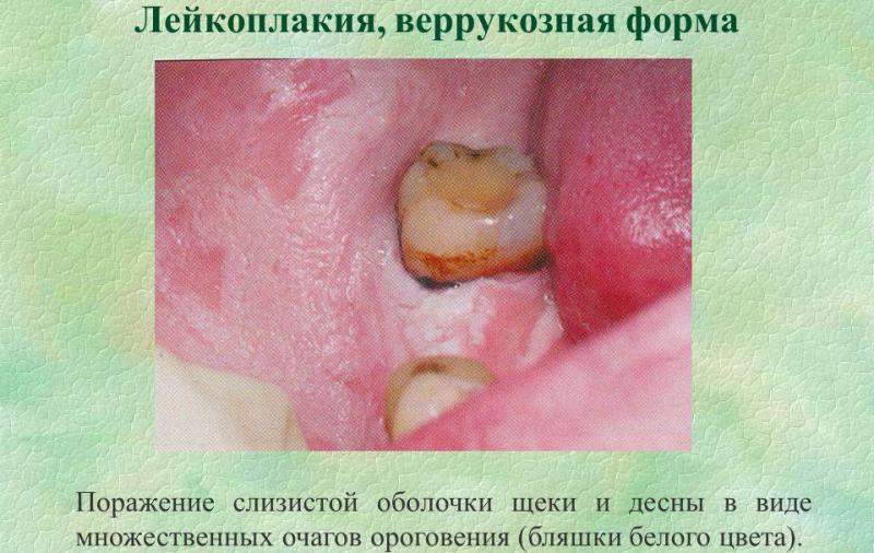 Виды и формы Виды и формы