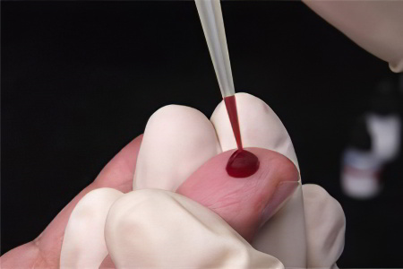 Анализ крови на глисты