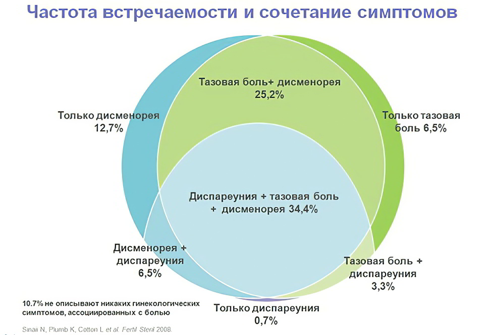 частота