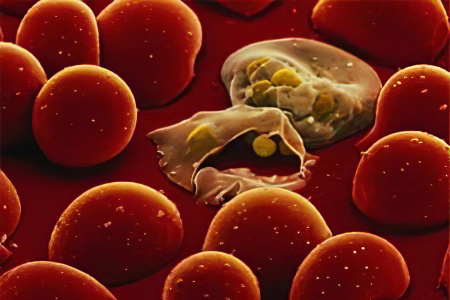 Что такое малярия