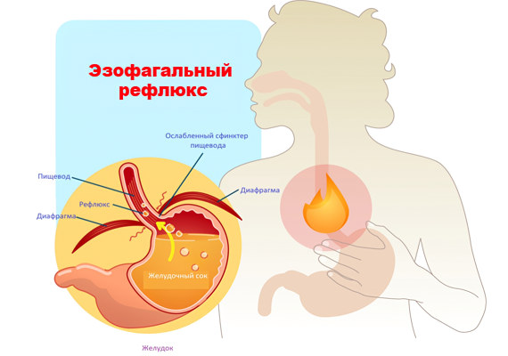 Ферментативная форма