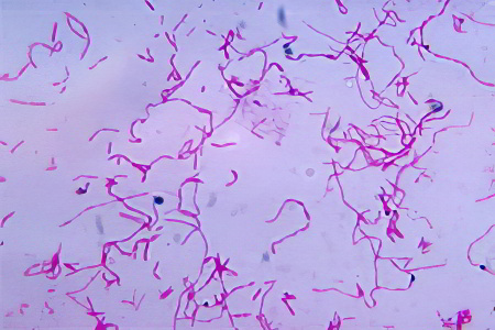 Фузобактерии