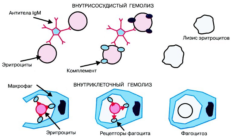 Где происходит гемолиз