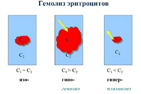 Где происходит гемолиз