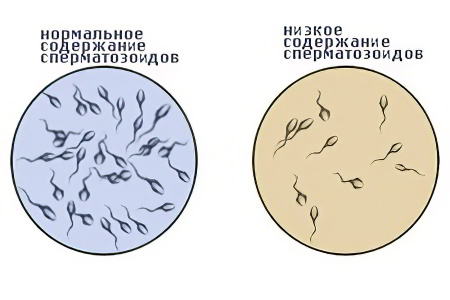 Характеристика спермы