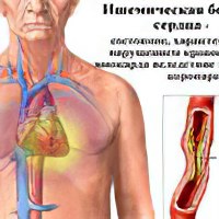 Диета при ишемической болезни головного мозга