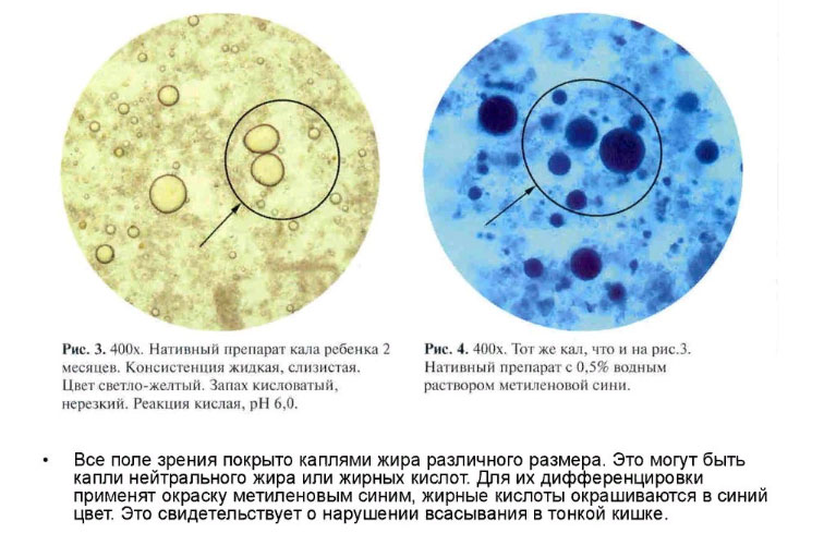 Жирные кислоты