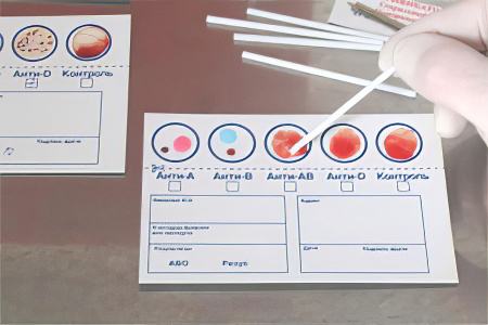 Как определить группу крови