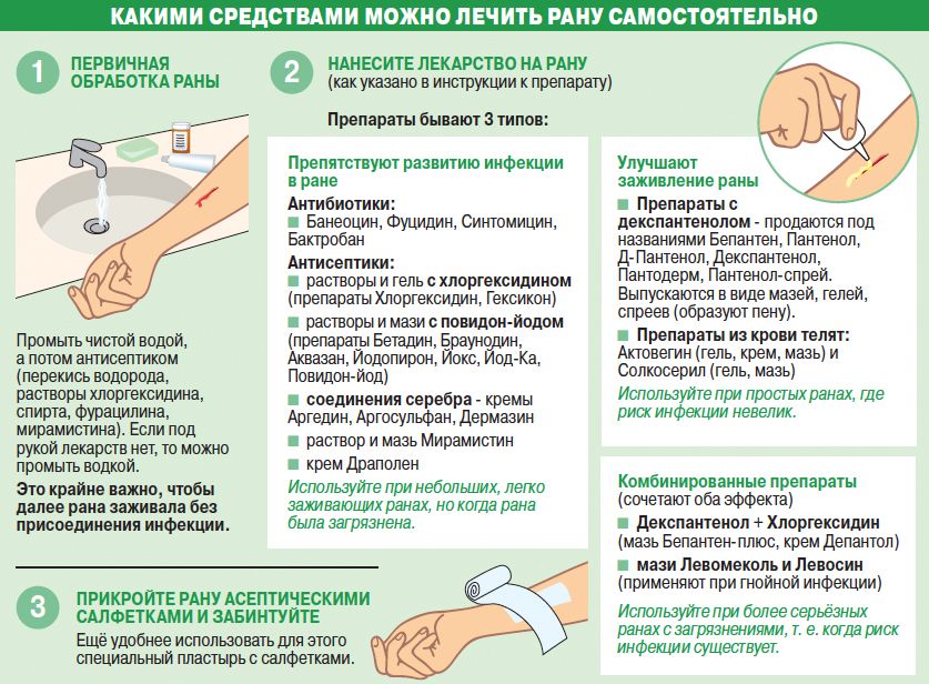 какими средствами