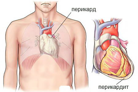 Классификация