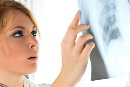 Лечение пневмосклероза лёгких