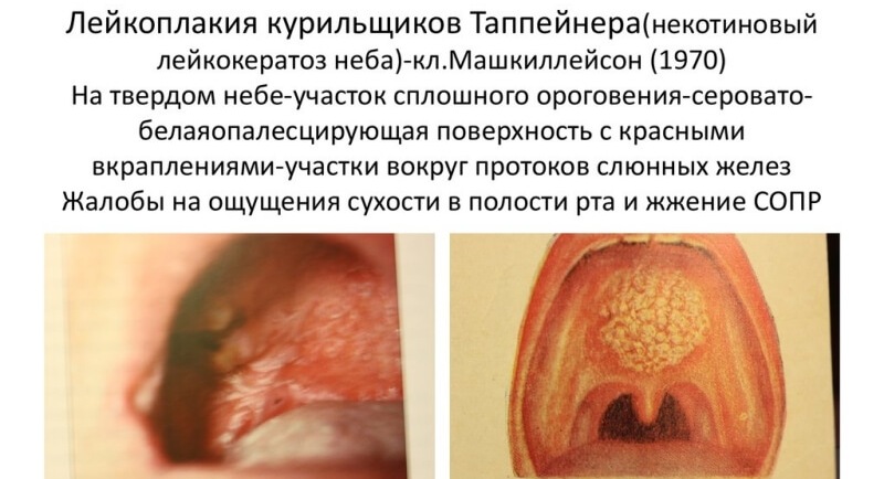 Виды и формы Виды и формы