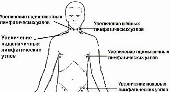 Паховый лимфоузел у женщин где. Надключичные и подключичные лимфоузлы. Надключичные лимфоузлы расположение. Схема расположения надключичных лимфоузлов. Надключичные лимфоузлы расположение расположение.