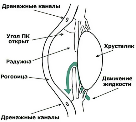 Открытоугольная глаукома