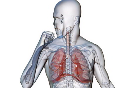 Пневмосклероз лёгких