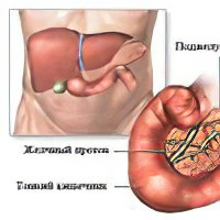 Что такое поджелудочная железа, где находится, как болит?