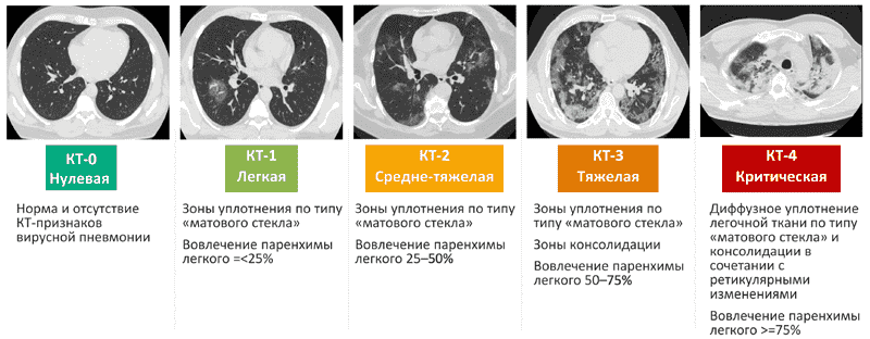 Как вычисляется процент поражения