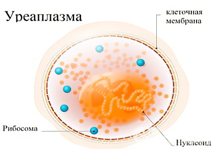 Причины уреаплазмы у женщин