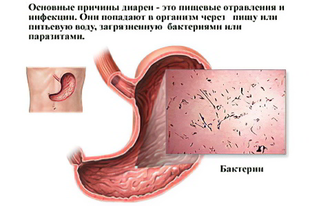 Причины диареи у взрослых