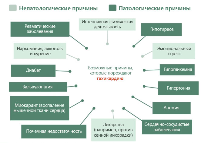 Причины синусовой тахикардии