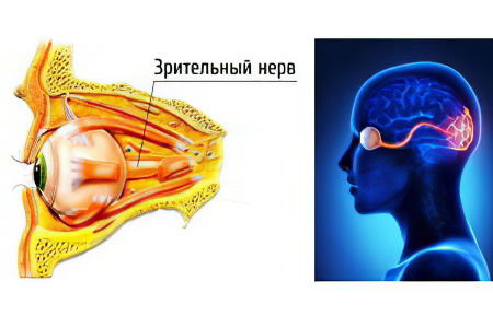 Причины атрофии зрительного нерва