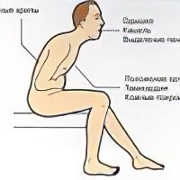 Инвалидность при астме и сахарном диабете