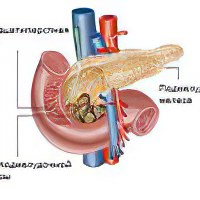Рак поджелудочной железы